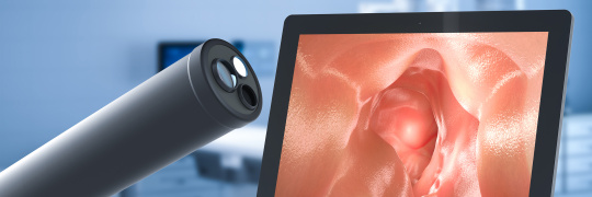 Endoscope and a screen showing the results of an endoscopy